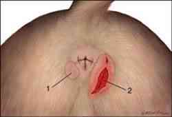 sacos-anales sacos anales