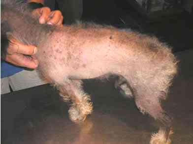 alopecia2