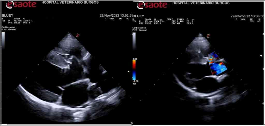 caso tetralogia de fallot ecocardiografia